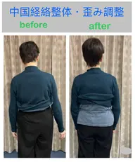 【骨盤・背骨の歪み】全身バランス調整体験40分| 新規限定 （現金払いのみ）