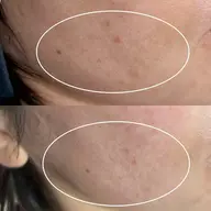 フェイシャルワックス