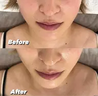 💛理想のフェイスラインへ【クリスティーナ フォーエバーヤング】💛