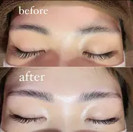 ハリウッドブロウリフト