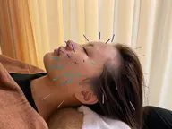 🌻小顔×肌質改善🌻美容鍼➕エステ➕筋肉ほぐし