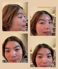 新メニュー　LHALALA total care(首​〜​お顔​〜​頭皮)