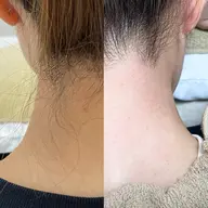 後ろ姿から垢抜け❤️うなじデザインワックス