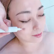 痛くないシミケア 20分当て放題!毛穴洗浄付き 60分コース