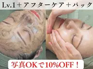 ■人気NO.1■ハーブピーリング[剥離なし約10回分の効果]ニキビケア/毛穴ケア¥35,100