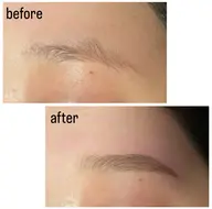 ハリウッドブロウリフト/HBL