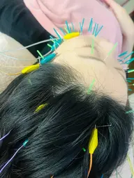 電気美容鍼＋ヘッドマッサージ🪡リッチコース