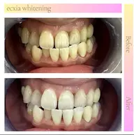 9分✖︎2回   ¥980  特別料金なし