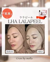 肌改善✨ダウンタイム無し！憧れの水光肌へ🫧🫧韓国美容​〜​ララピール​〜​¥12,800(通常)⇒¥9,800(初回限定)