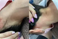 ブラジリアンワックス【襟足】