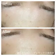 ⭐️お悩み別に施術⭐️肌育ハーブピーリング+フェイスワックス90分