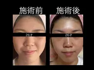 🌷エステ➕極上の美容液付き