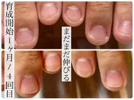 本格育爪モニター❁3回コース👐丁寧なカウンセリング付✨️