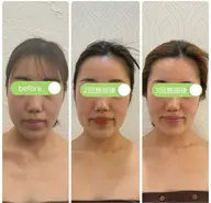 【新規】【平日限定】整形をお考えの前に!ダウンタイムのない整形級・頭蓋骨小顔矯正90分