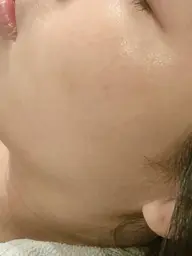 【オプション】ヒト幹細胞炭酸&成長因子パック《トーンアップ&引き締め美肌》