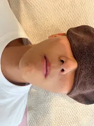 ヒゲ脱毛初回3300円、男性スタッフが担当できます