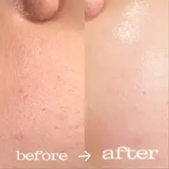 ラッシュリフト+フェイスWax口周り