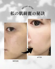 美白、シミ、くすみ、フェイシャルリンパ付き