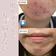 《夜専用🌙オーダーメイドフェイシャル ＋ヘッドorフットマッサージ10分》