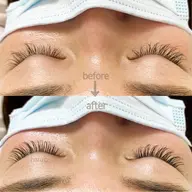 《何回でもOK》上30分付け放題〈リペアのみ〉