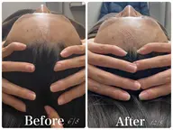 💆🏻‍♀️【究極の小顔コース！！】頭蓋骨矯正付き100min（¥24,200→¥4,950）※20歳以上の方限定