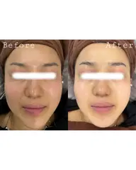 ✨【透明感UP美肌】シミ・くすみ・たるみ改善フェイシャルコース✨