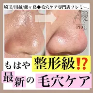 本気の毛穴改善Bコース(デコルテマッサージ付) ※毛穴エクストラクション プロ