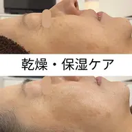 ぷるっとモチ肌【乾燥対策】剥けないハーブピーリング(パワーローズ付き)