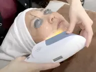 【美白針】120分⭐️美容鍼 × IPL