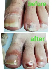 【シルバーコース】シルバー様の足の爪切りと爪磨きをさせて頂きます