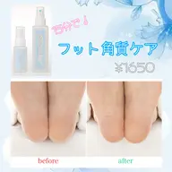 角質ケア🫧ガサガサかかとにサヨナラ👋