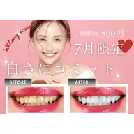 【口コミ投稿でお得☆】セルフホワイトニング(9分2セット) 1回¥3,980→¥500