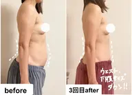 【これが私？！】お腹背中キャビ&バストアップで脂肪デザイン☆上半身美ボディ90分