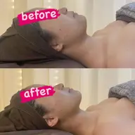 最新3Dリフト6000ショット→肌別トリートメント→導入EMS（デコルテマッサージ付）✨