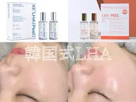 🉐平日限定🉐【即効ツヤ肌】韓国肌管理ララピール+再生LED