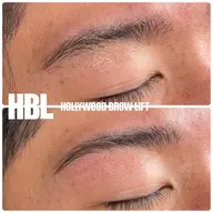 ハリウッドブロウリフト【HBL】