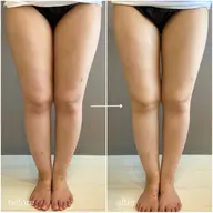 ミニモ学割🌸ダイエット応援価格‼️📣【お尻、太もも、ふくらはぎ】最新機器を使い身体水脈を整え太りにくい身体に❣️