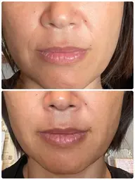 ✨当店No.2✨バイオセルショット65