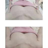 マシュマロバスト施術★最新微弱電流　¥9,900