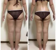 【人気No.1鬼痩せコース】よもぎ蒸し+スリムレーザー30分(メンズOK)