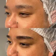 メンズ眉毛タトゥー1回目 消えない眉毛