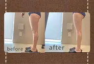 【🔥痩身｜体質改善｜浮腫改善🔥】下半身集中☆痩せたい方必見！！☆パワーレメディ『60分』