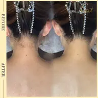 本当は気になる【自分では見えない後ろ】透明チャージ✨️背中うなじ脱毛★