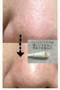 毛穴ケア⁂角栓吸引⁂引き締めパック⁂ラジオ派リフトアップ