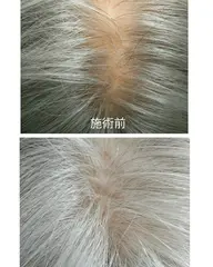 増毛エクステ　800本