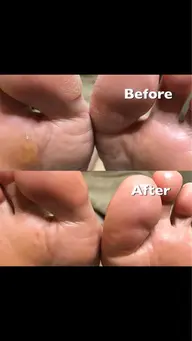 ドイツ式フットケア40分