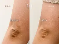 ラメラ　Sパーツ（唇、膝、肘、くるぶし、Oゾーン）