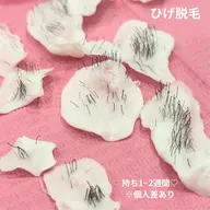 男性ひげwax脱毛