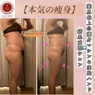 即効★【全身サイズダウン】ハイパーEX&シェイプ凸凹セルライトつぶす+リンパ120分21800→