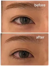 上下まつ毛パーマ［ラッシュリフト］+集中ダメージケアトリートメント付き🌿コーティング仕上げ